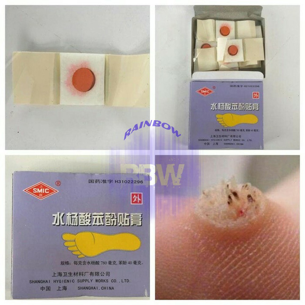 Koyo (1 BOX 6pcs) Plester Obat Kutil & Mata Ikan / Penutup Kutil / Koyo Kutil / Penutup Mata Ikan-2