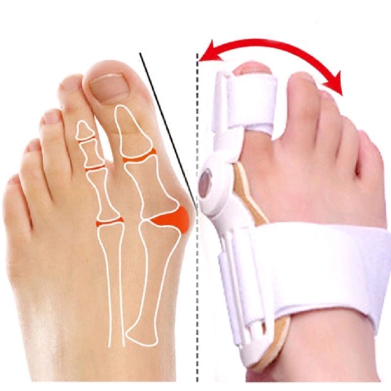 korektor pelurus jempol kaki hallux bunion toe straightener