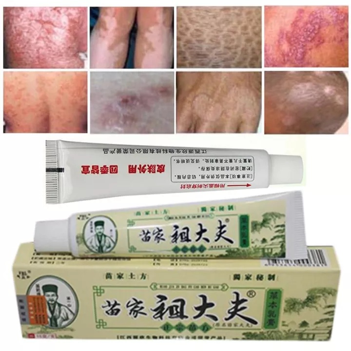 SALEP GATAL KULIT EKSIM PANU KURAP KUDIS KULIT JAMURAN KUTU AIR / OBATI ALERGI / GATAL SELANGKANGAN / OBAT GATAL AMPUH Salep Dermatitis Salep ZUDAIFU 100% Original Psoriasis Eksim Jamur Kurap Alergi Kulit Cream