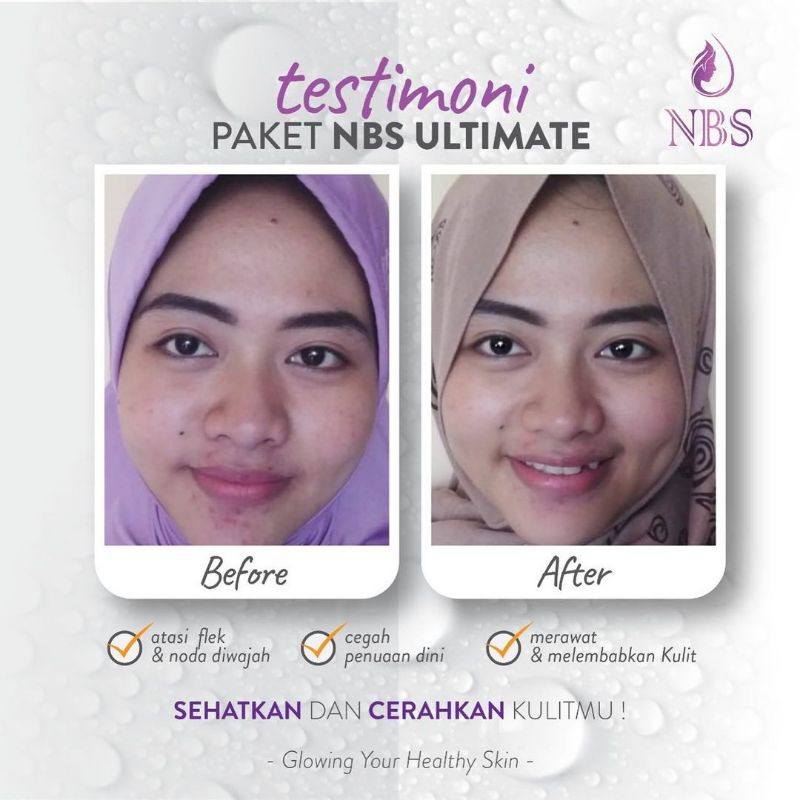 produk NBS /Cream NBS/ cream wajah glowing