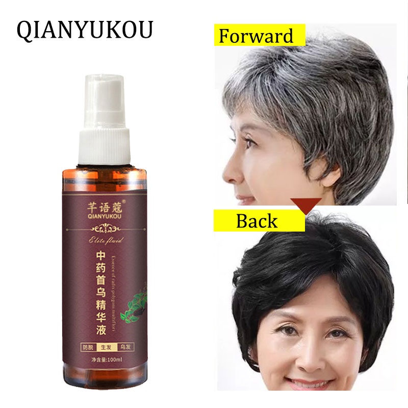Serum Rambut Hitam Hitam spray 100ml Polygonum Multiflorum Rambut putih alami hingga rambut hitam 100% ekstrak tumbuhan asli Rambut putih tercepat di Indonesia menjadi rambut hitam Rambut hitam permanen Menutrisi Akar Rambut Rambut Putih-1