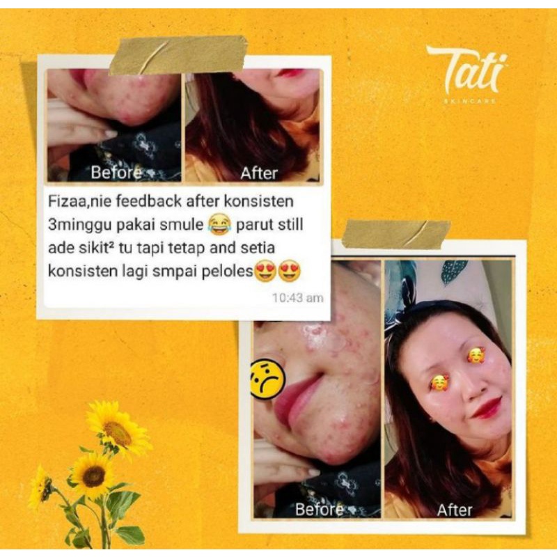 TATI skincare 10 gr paket bundling uv+day cream