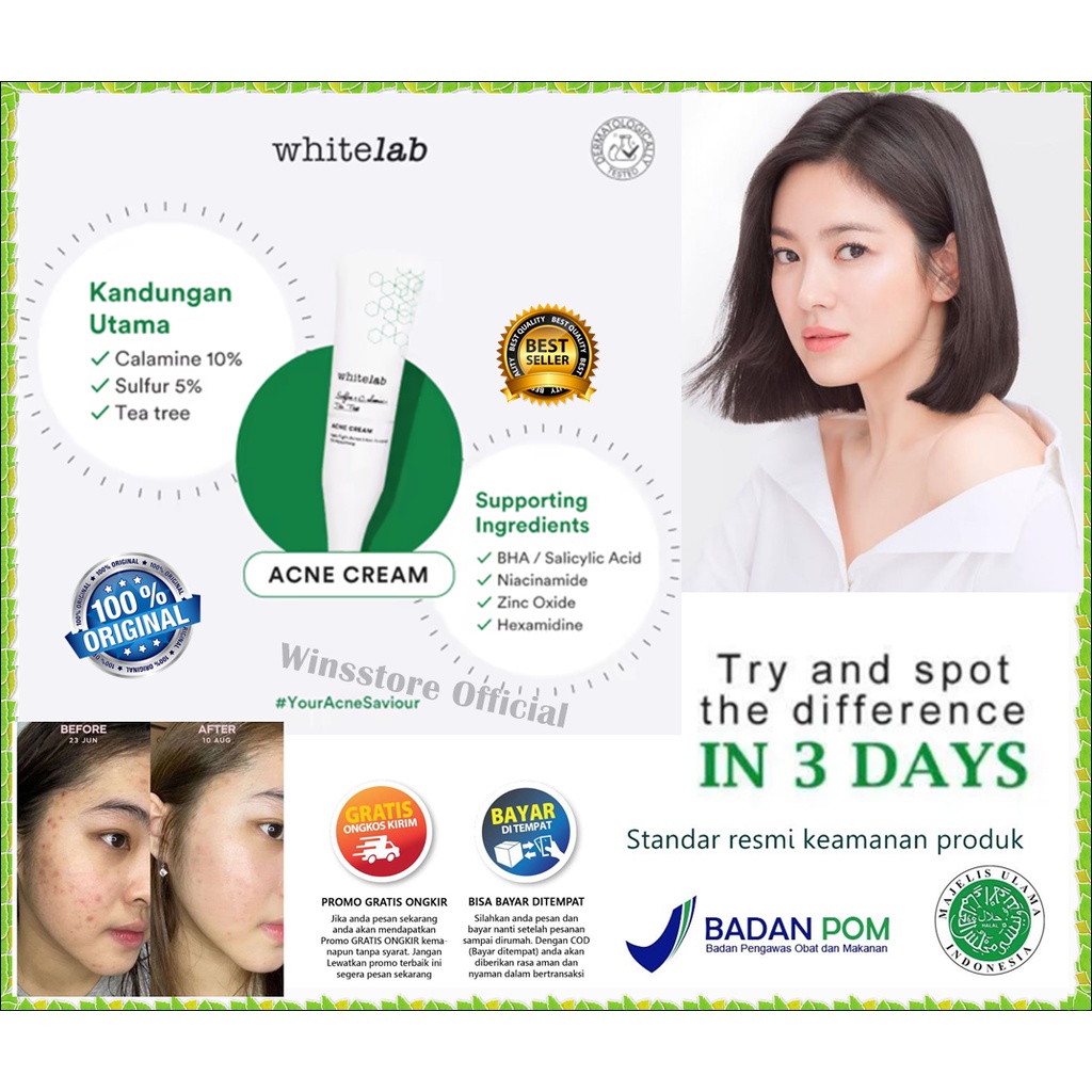 [ORI] Whitelab Acne Cream dengan Kandungan Utama Calamine + Sulfur + Tea Tree AMPUH Mengeringkan Jer