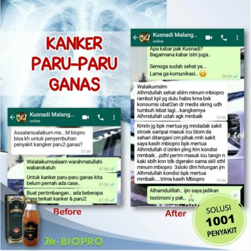 M Biopro Mbiopro Herbal Asli Halal 100% Original Untuk Ambien, Sesak Nafas Dan Mengobati Penyakit Lain-2