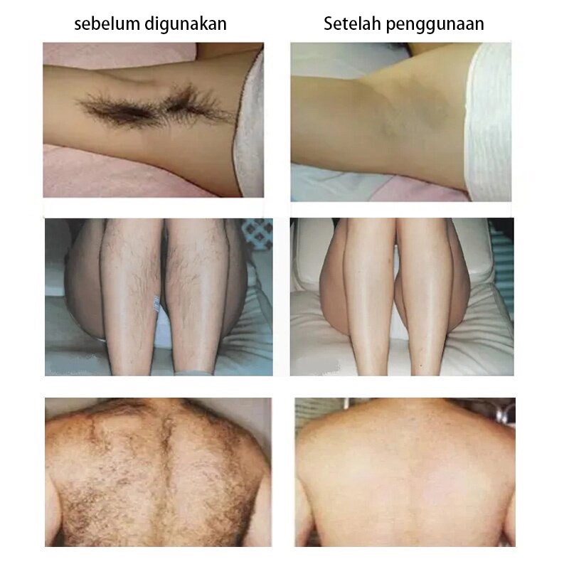 hair removal cream hair removal miss v penghilang bulu ketiak permanen penghilang rambut semprotan ringan dan tidak menyebabkan iritasi Tersedia untuk ibu hamil