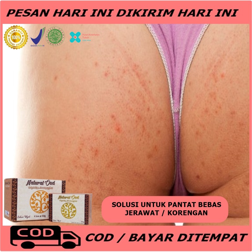 Sabun pantat hitam - Obat pantat bruntusan - obat pantat burik dan koreng - Obat pantat gatal dan ru
