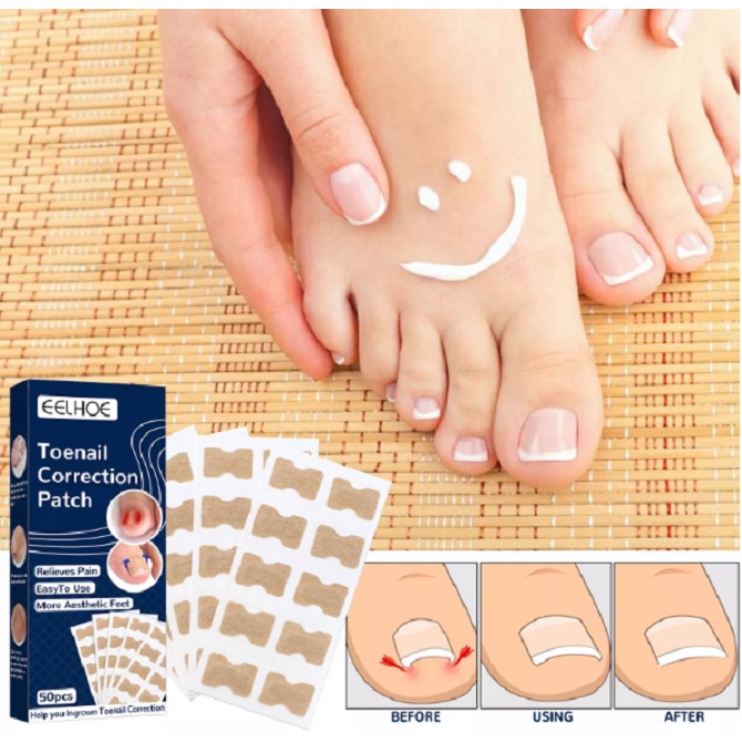 Plester Perawatan Kuku Kaki Elastis Untuk Pedicure 50pcs