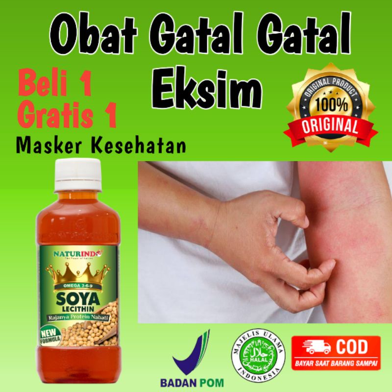 OBAT GATAL GATAL BENTOL BENTOL ALERGI HERBAL PALING AMPUH HEPATIFIT NATURINDO