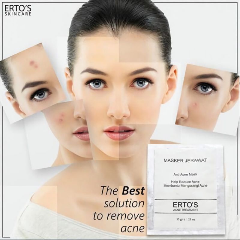 Ertos Masker Anti Jerawat Paling Ampuh Anti Acne Mask ERTO'S Skincare Original BPOM