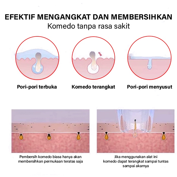 GM Bear Alat Pembersih dan Penyedot Komedo 1279 - Blackhead Remover-2
