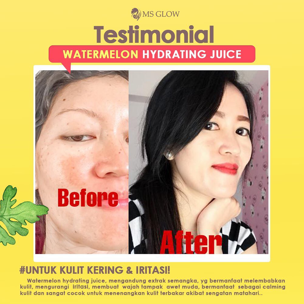 Jual Hydrating Juice MS Glow Moisturizer Pelembab Kulit Kering Mengurangi Iritasi Kulit Original