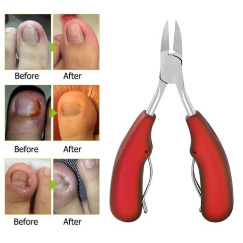 GUNTING KUKU JEMPOL KAKI Anti Cantengan Toe Nail Clipper Edge Cutter