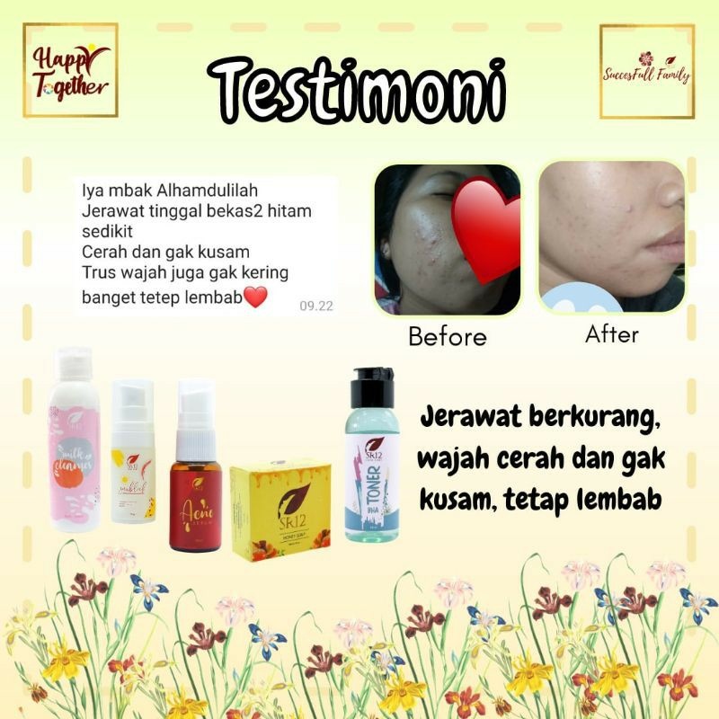 ACNE SERUM SR12 / SERUM WAJAH / SERUM JERAWAT / SERUM WAJAH / SERUM HERBAL