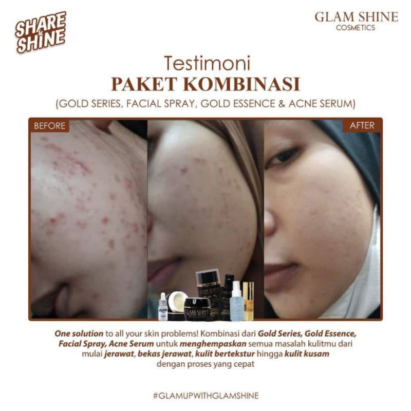 glamshine gold series - cream glamshine - glamshine cream glowing - glamshine black - glamshine platinum - glamshine gold - cream glamshine - skincare glamshine - glamshine Skincare