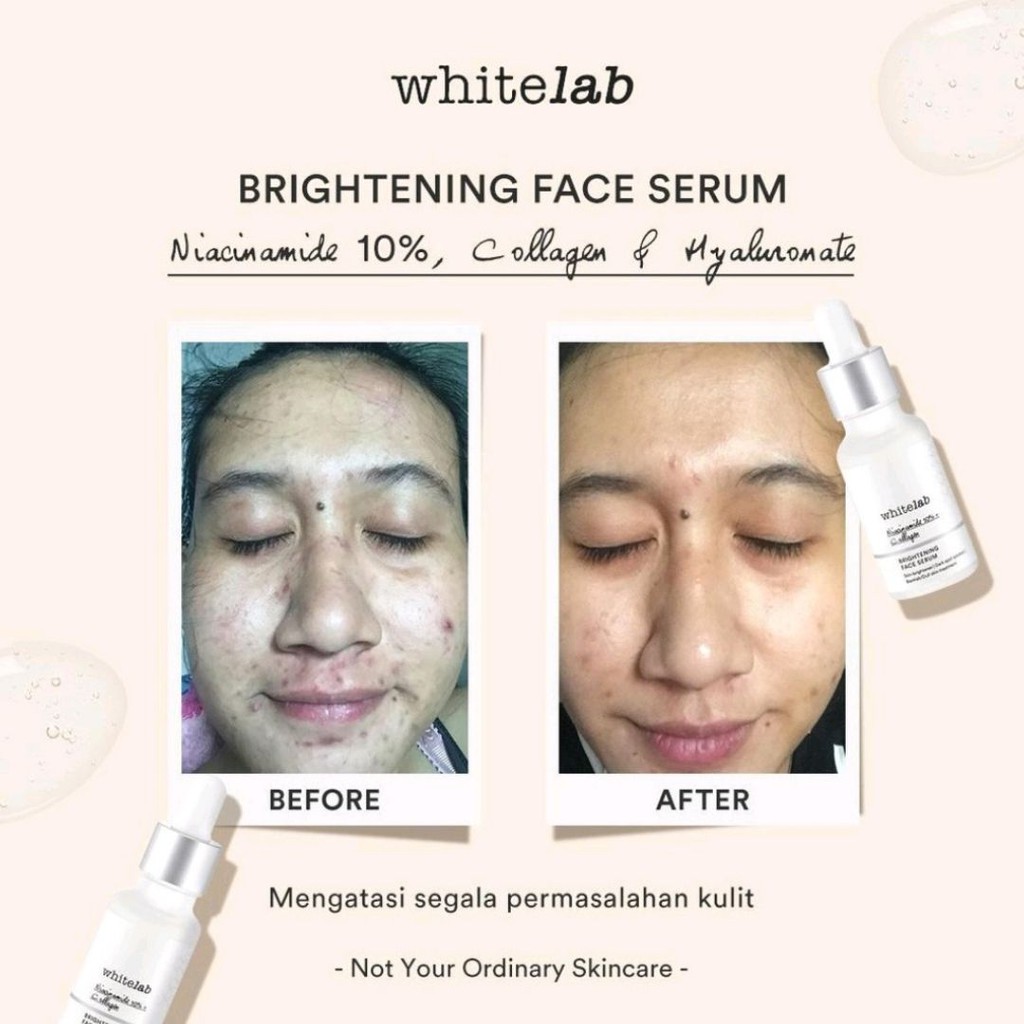 Whitelab Brightening Face Serum / Whitening serum penghilang noda hitam kulit wajah Original BPOM