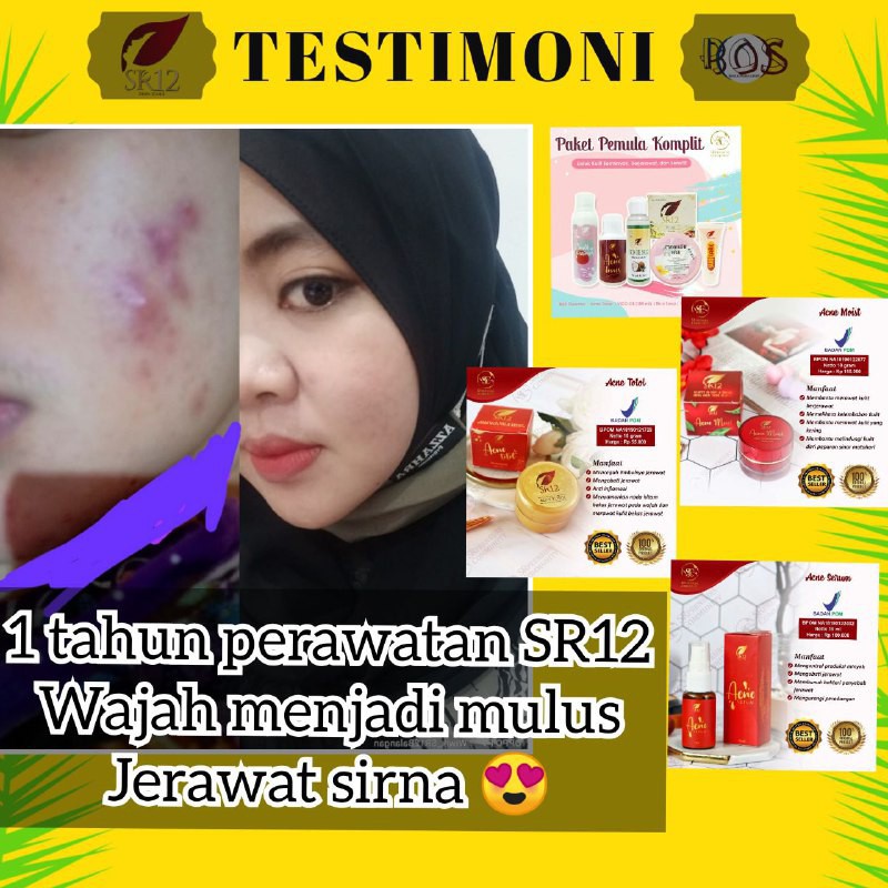 Acne Serum Wajah SR12 Penghilang Jerawat Bruntusan Komedo Berminyak Original BPOM 20ml