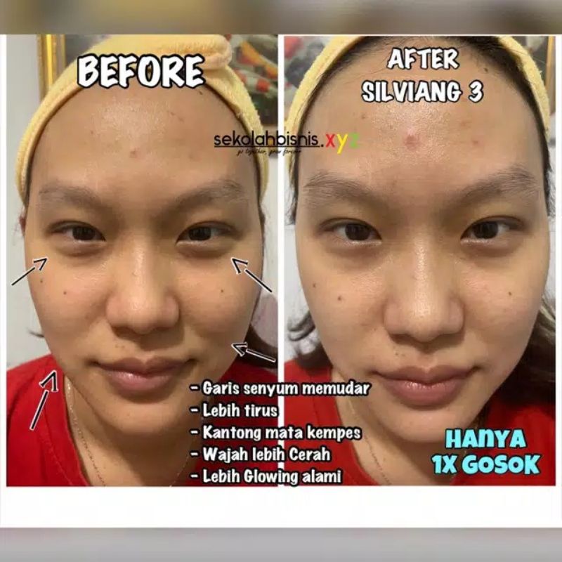 Silviang 3 Hot &amp; Cool Skin Device Setrika Wajah Beautyzen Soft Cleansing Lotion Refreshing Toner Original kk Indonesia