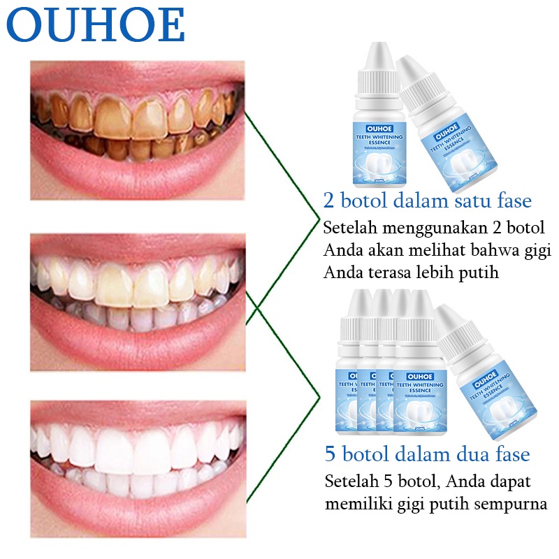 Perawatan Mulut Toothpaste Pemutih gigi Pasta gig Teeth whitening Cairan gigi putih 30ml Menghilangkan noda teh Gigi kuning Plak Napas jernih melindungi gusi Jaga kebersihan mulut