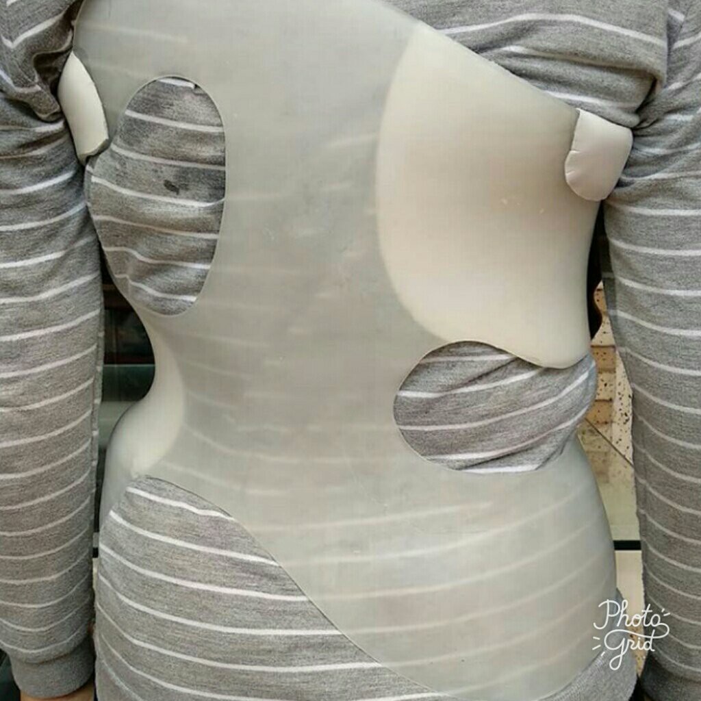 Muenster Scoliosis Orthosis / MSO Brace / Scoliosis Brace / Postur / Koreksi Skoliosis / Ortopedi