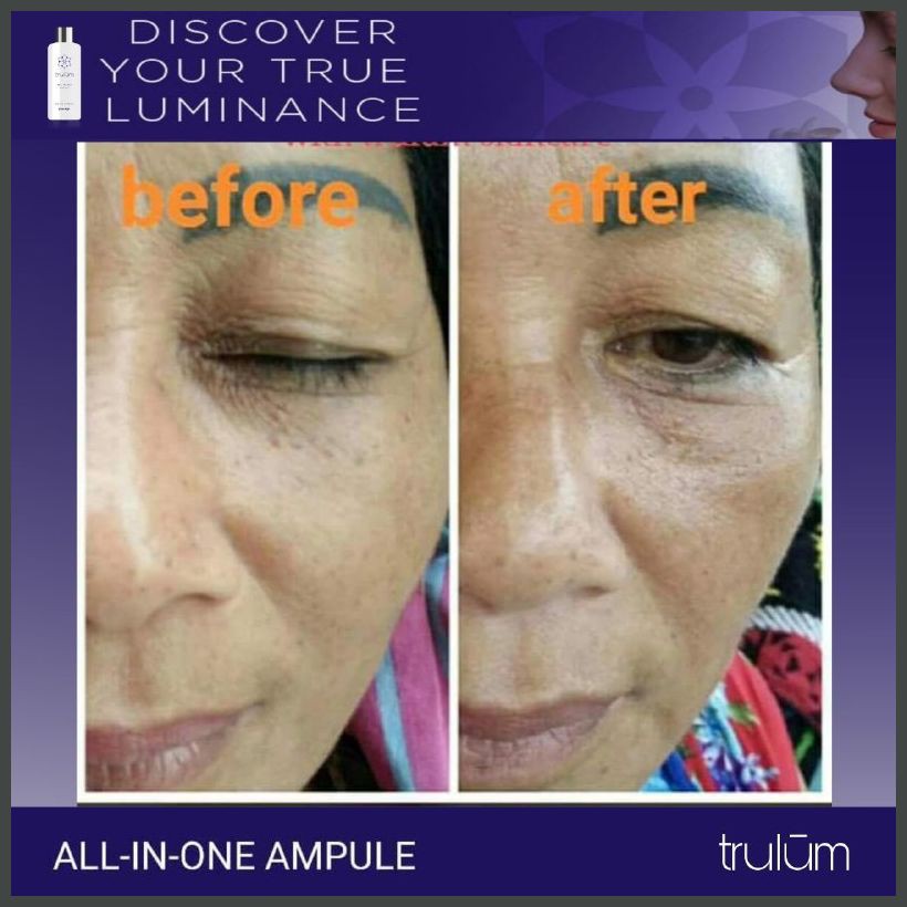 ✉RESMIʊʊ Serum Untuk Wajah Kusam Dan Berminyak / Krim Untuk Memutihkan Wajah Secara Alami Untuk Pria