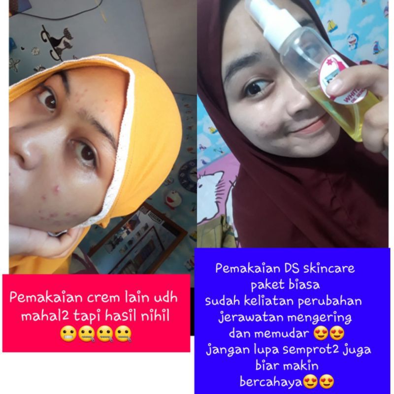 DS skincare whitening