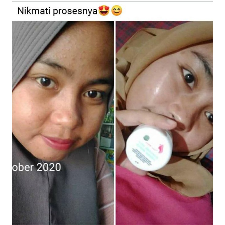 BAYAR DITEMPAT || NAHDA SKINCARE ORIGINAL 100% ORIGINAL || FREE BONUS MENARIK !!-4