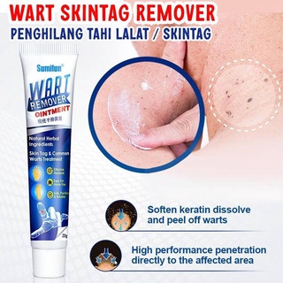 Warts Remover Cream Wart Treatment Skin Tags Mole Remover Plaster Cream Antibacterial Foot Wart Oint