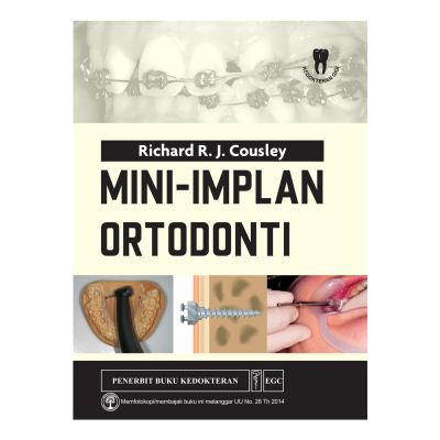 Original Mini-Implan Ortodonti CBSBY