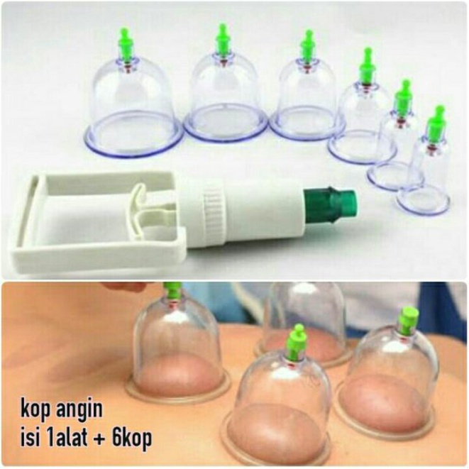 SHINE STAR - Kop Angin Bekam / Alat Bekam Lengkap Kongsui Isi 6 Tabung - Alat Cop Masuk Angin Cupping Therapy Kit / Mengobati Masuk Angin