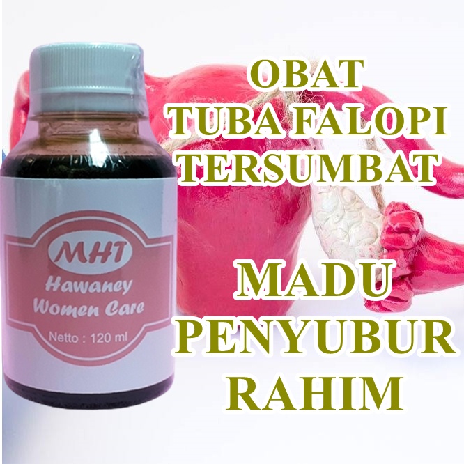 Obat Penyumbatan Tuba Falopi Di Apotik | Obat Tradisional Saluran Tuba Falopi Tersumbat | Obat Cina 