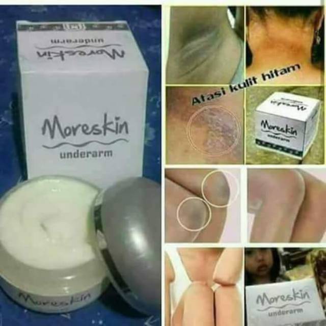 moreskin underarm