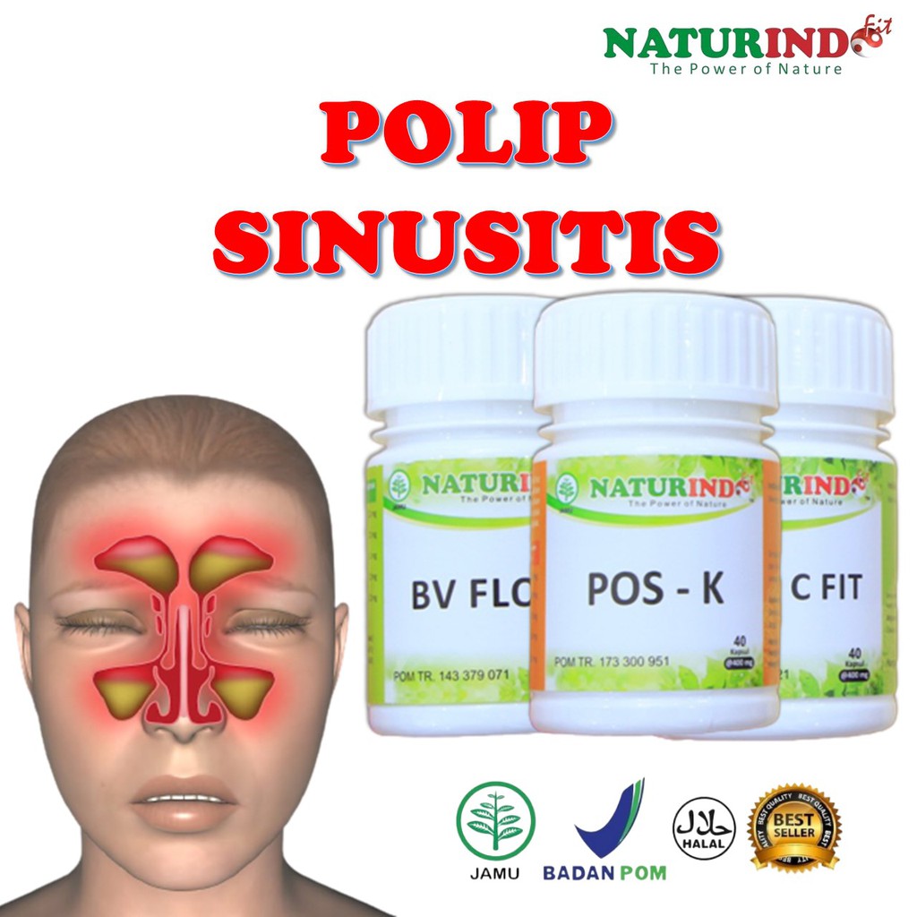 Jual Obat Herbal Sinusitis Polip Pembengkakan Kelenjar Hidung Infeksi ...