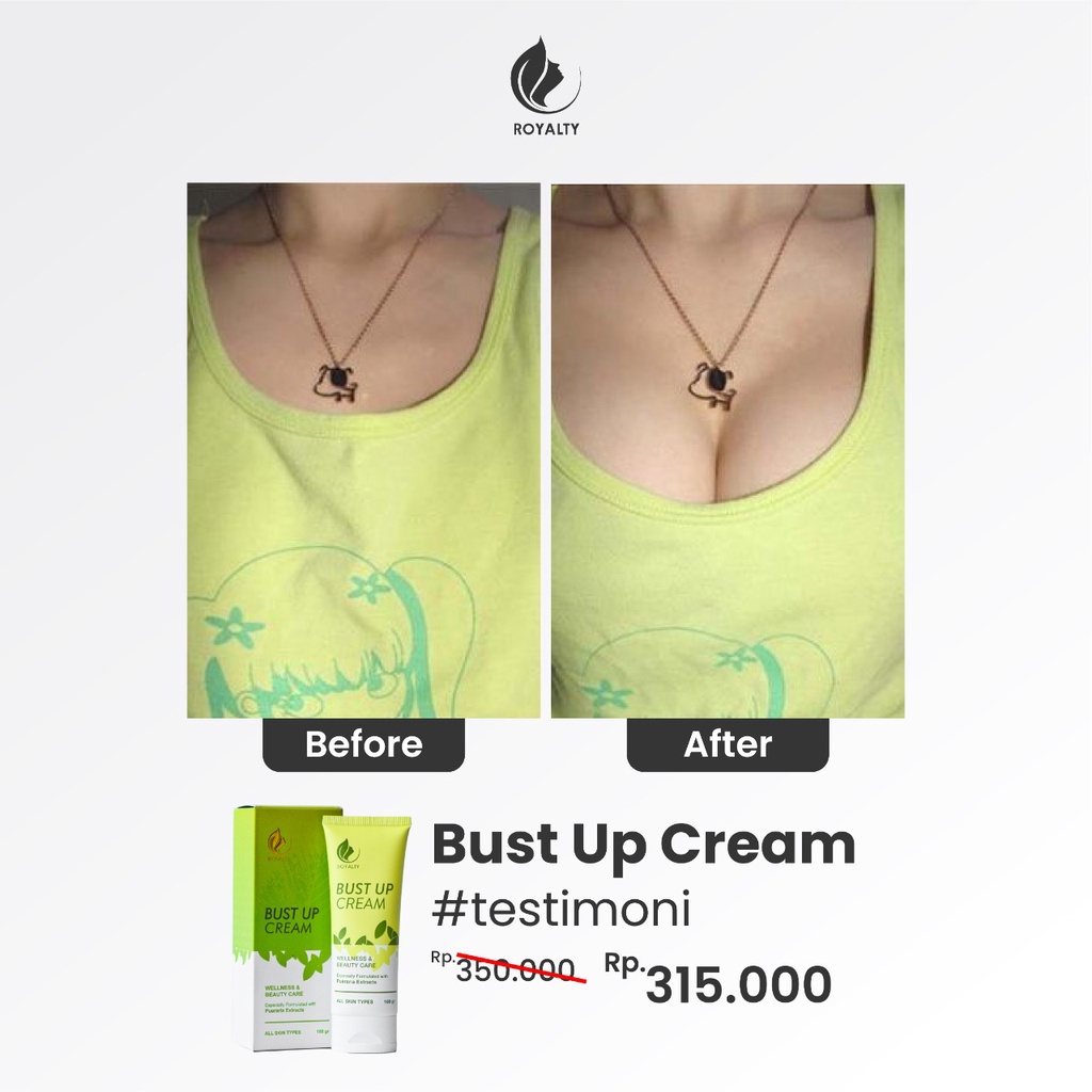 Pembesar Payudara dan  Pengencang Payudara Montok Padat Berisi Aman BPOM BUST UP CREAM Royalty