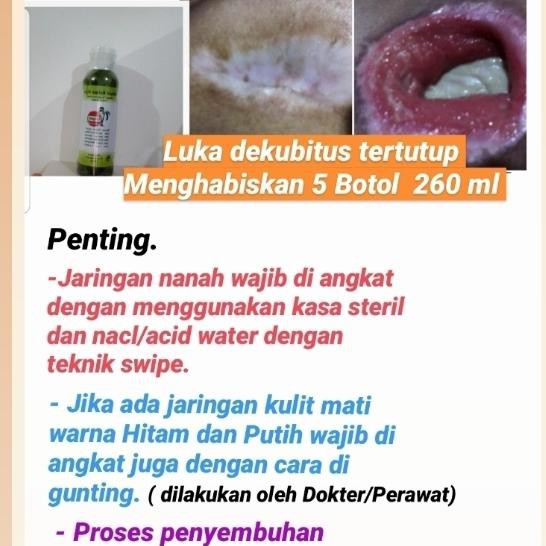 PUREGANTA 150ML OBAT AMPUH DEKUBITUS / ULKUS