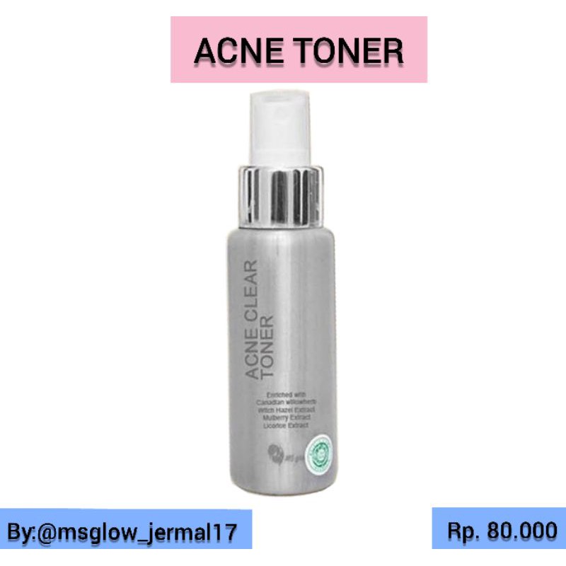 Acne Toner Ms Glow