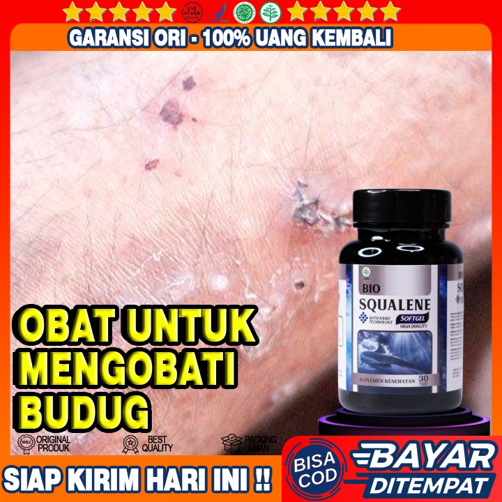 Obat Penghilang Budug - Obat Gatal Budug - Obat Budug Dewasa - Obat Budug Bernanah - Penghilang Beka