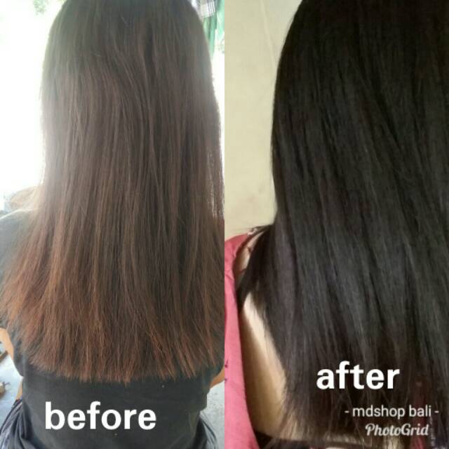 Serum rambut - Hair serum - Anti rontok || Serum rambut Cabelo penumbuh rambut ampuh-2