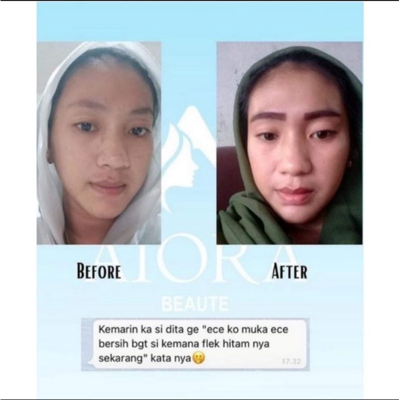 AIORA skincare by aditya amarzoni skincare artis