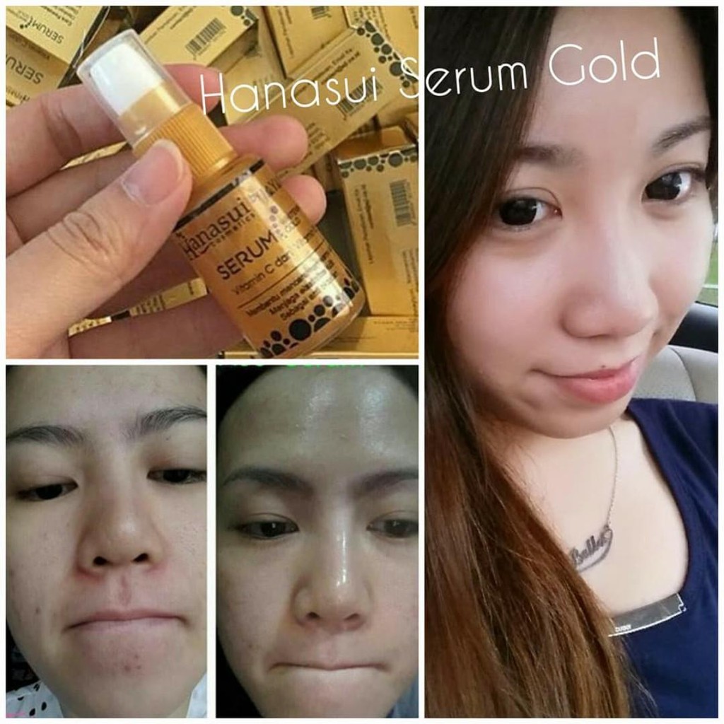 HANASUI - Serum | Whitening Gold Vit C Collagen Anti Acne