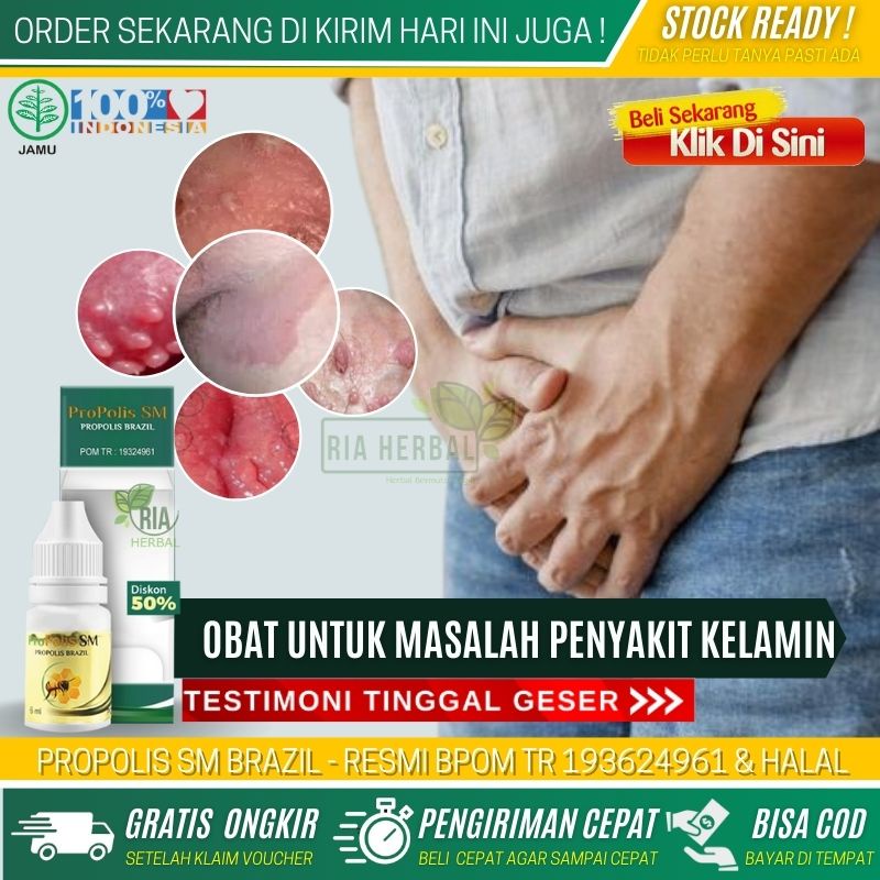 Obat Penghilang Jengger Ayam / Kutil Kelamin Tradisional - Menghilangkan Kutil Kemaluan di Batang at