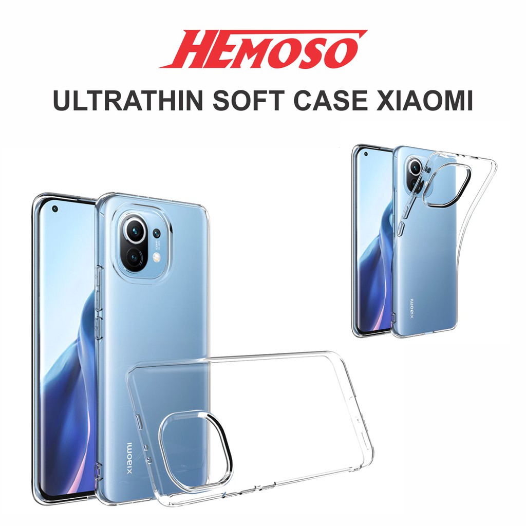 Case Ultrathin For Xiomi not8 not8pro not10 mix max