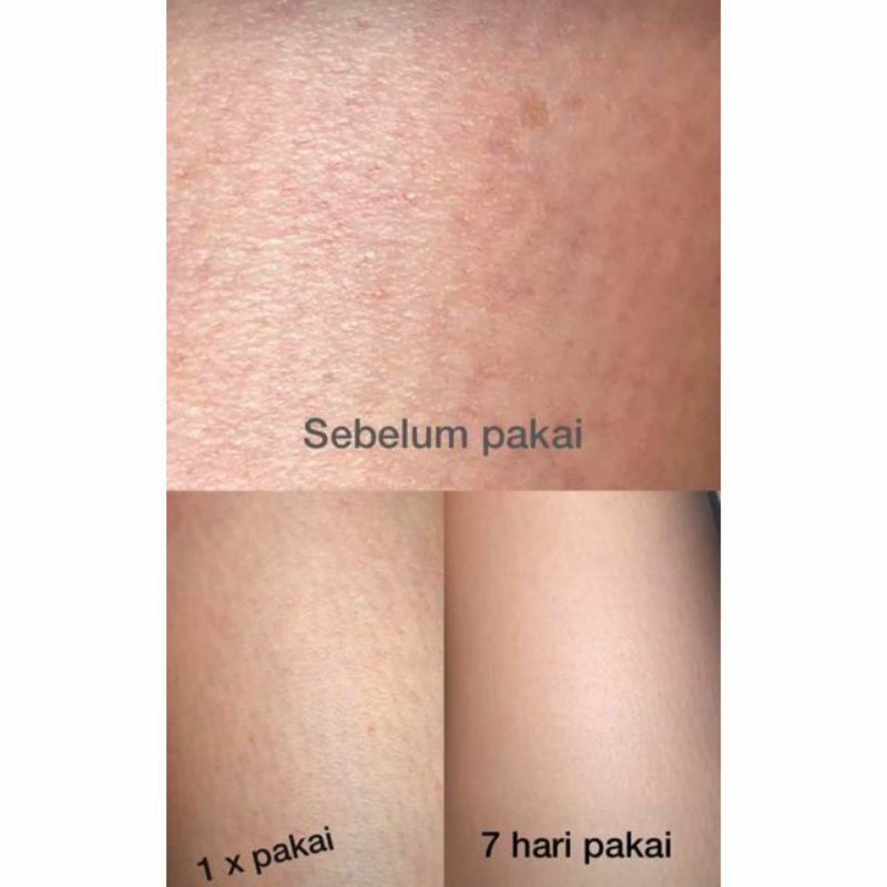 BIBILOP - Caviar Body Cream and Gold Serum - Missflolaks