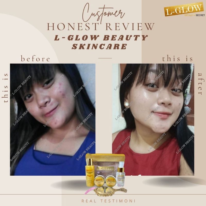 LGLOW BEAUTY SKINCARE BB GLOW DAY NIGHT CREAM GLUTA AHA SERUM LOTION BAR SOAP PEELING WHITE LUXURY