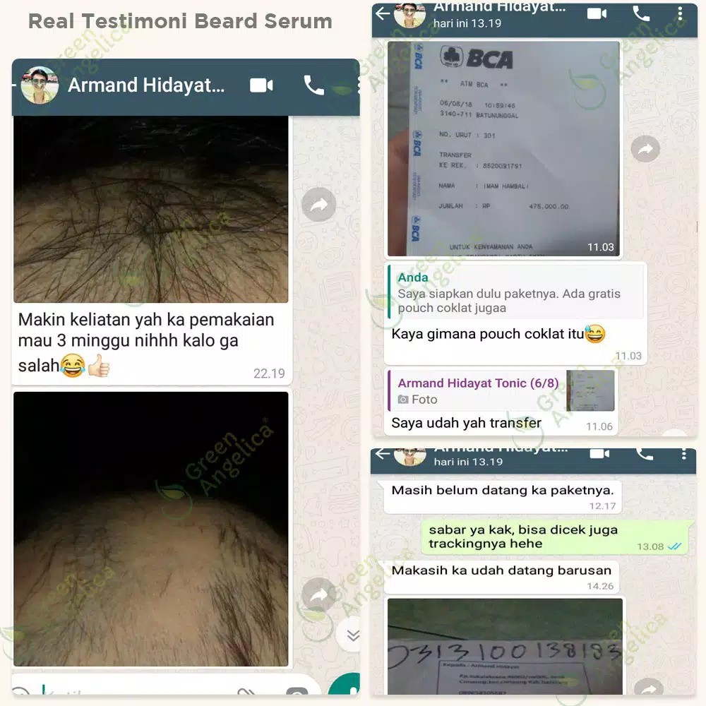 Green Angelica Paket Maksimal Penumbuh Rambut Botak Tipis dan Mengatasi Rambut Rontok Tanpa Ketergantungan BPOM-7