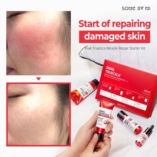 [Ready stok]Some By Mi Snail Truecica Miracle Repair Starter Kit set of 4