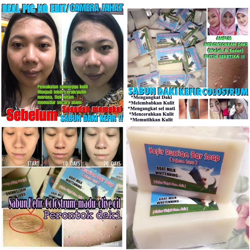 SABUN KEFIR COLOSTRUM / SABUN DAKI KEFIR KOLOSTRUM