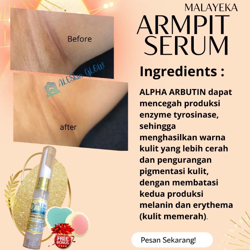 Pemutih Ketiak Ampuh Armpit Whitening Serum by Aleskin Glow