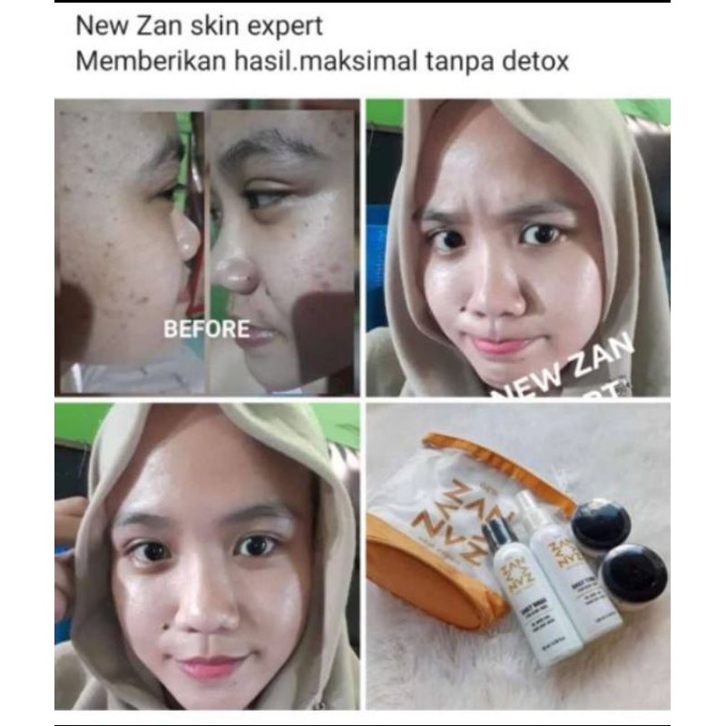 (BISA COD)skincare glowing New Zan skin expert