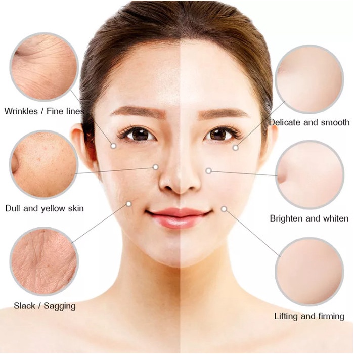 Anti Aging Keriput Wrinkle Noda Hitam Wajah Dark Spot Flek Hitam