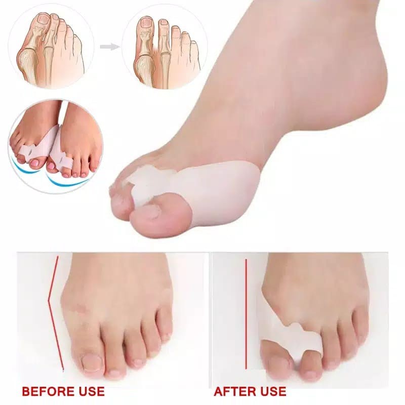 INSOLE SEPATU SILICON ANTI BUNION TOE INSOLE JARI INSOLE SILICON